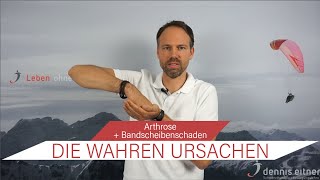 Die wahren Ursachen Arthrose  Bandscheibenschaden [upl. by Krahmer9]