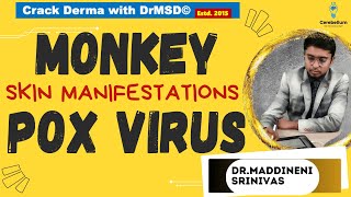 Monkey Pox virus  MPOX  Dermatological  SKIN Manifestations DrMSD Dr Maddineni Srinivas  WHO [upl. by Asiuol]