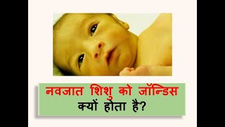 Neonatal Jaundice l Polio l causes l symptoms l treatment l ayurveda [upl. by Llegna]