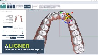 Clear aligner software thermoforming or direct printing [upl. by Nicolis679]