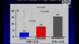 Who Needs a Coronary Artery Stent [upl. by Parrisch494]