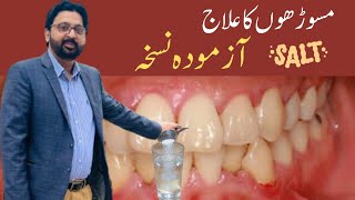 How to SWISH with SALT WATER to Cure Gum Disease Receding Gums and Gingivitis [upl. by Aralomo211]