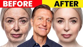 The Ultimate Face Transformation–Dr Bergs Best Remedy for Dry Skin and Wrinkles [upl. by Ahsiya]