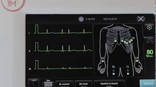 How to Use the Welch Allyn CP150 EKG Machine and Product Features [upl. by Lapides]