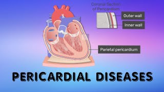 Pericardial diseases  Pericarditis [upl. by Necila]