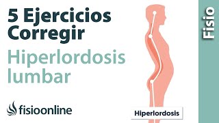 5 ejercicios para corregir la Híperlordosis lumbar o exceso de curvatura de espalda [upl. by Enirehtakyram]