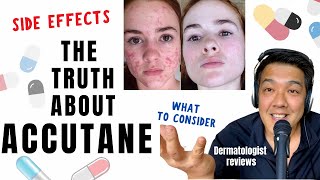 ACCUTANE  Dermatologist Review Unbiased [upl. by Minardi]