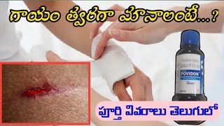 Povidone Iodine Solution Uses In Telugu  Antiseptic  Microbicidal Solution [upl. by Iralav943]