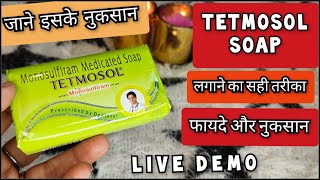 Tetmosol Soap  Tetmosol Soap Benefits  टेटमोसोल साबुन  फायदे और नुकसान  Shruti Mishra [upl. by Kempe]