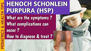 Henoch Schonlein Purpura HSP Causes Symptoms Diagnosis amp Treatment In Pediatrics [upl. by Petracca]