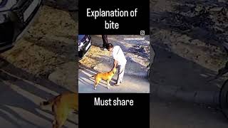 Dog bite 😱 click 👆part 2 [upl. by Blatman]