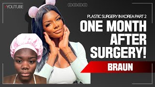 Jaylyns ethnic nose job Rhinoplasty and Facial Contouring Surgery recovery timeline  One month [upl. by Hiroshi]