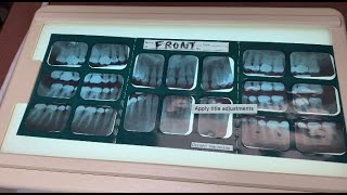 Mount a Traditional FMX For the purpose of recognizing Dental Anatomy [upl. by Nicholson]