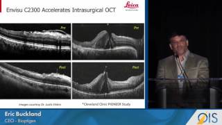 Bioptigen Driving Intrasurgical OCT Use OISASRS 2016 [upl. by Isiah]