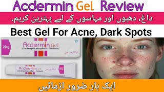 Acdermin Gel Review  Acne gel  Acne Cream Acne treatment  Dr Ahmed Bukhari [upl. by Aihsened273]