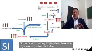 Laboratory diagnosis of jaundice [upl. by Ateinotna]