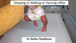 Neonatal Reflex  Stepping Reflex  Walking Reflex  Dancing Reflex I Pediatrics [upl. by Atihana553]