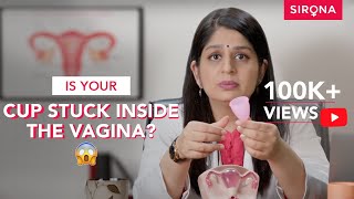 How to Remove a Menstrual Cup For Beginners  Know From a Doctor  Sirona Hygiene [upl. by Iddo]