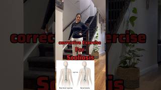 Scoliosis Exercises ytshorts exerciseshorts scoliosis physiotherapy [upl. by Ilera]