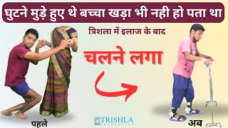 मेरा सेरेब्रल पाल्सी से प्रभावित बच्चा अब चल पा रहा है  Crouch Gait Pediatrics  Trishla foundation [upl. by Unni722]