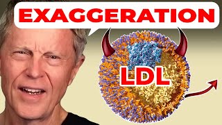 Dr Brewers Friday Rant NEW Evidence on LDL Cholesterol and Clogged Arteries [upl. by Veronique959]