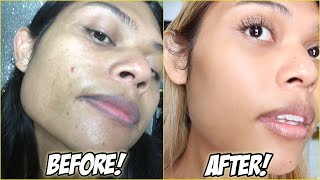 MY UPDATED SKINCARE ROUTINE  unsponsored skincare for acne [upl. by Ttirrej]