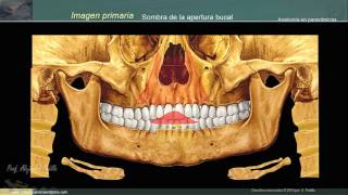 Estructuras anatómicas en la radiografía panorámica II [upl. by Nilekcaj]