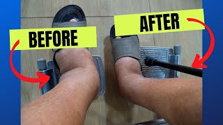 Best Exercises amp Remedies To Shrink Ankle Swelling [upl. by Grosberg]