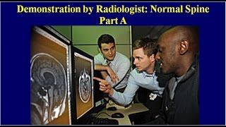 11A KPacs Tutorials A Radiologist Demonstrates a Normal Spine [upl. by Llehsram]