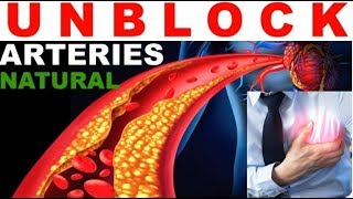 Reversing Atherosclerosis Naturally Herbal Cure How To Reverse Reduce Plaque Buildup In Arteries [upl. by Norvin]