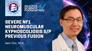 Severe NF1 Neuromuscular Kyphoscoliosis sp Previous Fusion  Sam Cho MD [upl. by Yendroc]