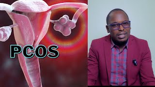 Polycystic Ovary Syndrome  How  Signs  Causes  Diagnosis  Treatment [upl. by Beitris]