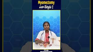 Myomectomy ఎలా చేస్తారు  doctor tanuku telugu information ytshorts youtubeshorts [upl. by Venetis]