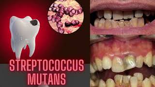 streptococcus microbiology lecture Streptococcus mutans S mutans Easy Microbiology [upl. by Mixie792]