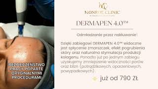 ZABIEG DERMAPEN 40 MONROE CLINIC KIELCE [upl. by Auqinehs]