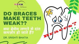 Do braces make teeth weak क्या ब्रेसेस लगाने से दांत कमज़ोर हो जाते हैं Dr Srishti Bhatia [upl. by Lourie]