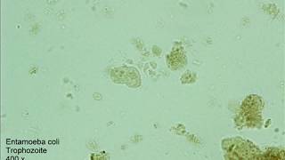 Entamoeba coli [upl. by Bevers242]