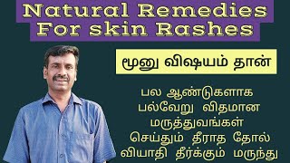 Natural Remedies for skin Rashes simple method to recover skin issues  3simple steps [upl. by Annoel]