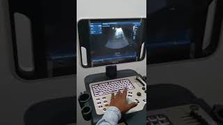 MindrayiLive Pro Demonstration  Ultrasound Tutorials [upl. by Nevin584]