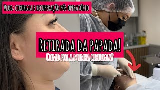 FIZ A LIPO DE PAPADA  como foi a cirurgia Doeu Como está sendo a recuperação [upl. by Olumor]