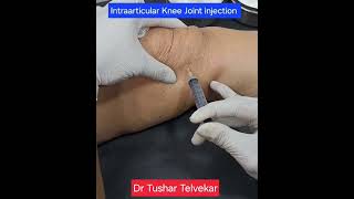 kneeinjection kneepain Intraarticularkneeinjection drtushartelvekar osteoarthritis [upl. by Karl]