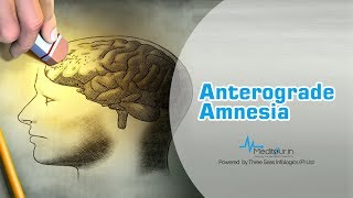 Anterograde amnesia [upl. by Eceerahs727]