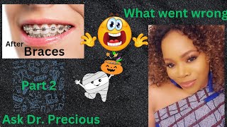 What happened to my straight teeth part 2 Why do teeth move after braces Ask Dr Precious [upl. by Guthry820]