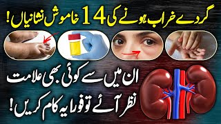 14 Silent Symptoms Of Kidney Failure  Kidney Disease Signs Causes And Symptoms Urdu Hindi [upl. by Nylasor]