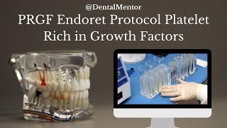 PRGF Endoret Protocol Platelet Rich in Growth Factors [upl. by Noivaz]