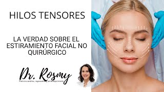 HILOS TENSORES  Todo lo que quieres saber  Estiramiento facial no quirúrgico [upl. by Austine]