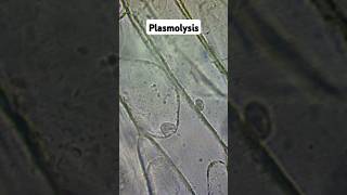 Plasmolysis and Osmosis biology gcse [upl. by Inor]