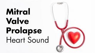 Mitral Valve Prolapse  Heart Sounds  MEDZCOOL [upl. by Marni815]