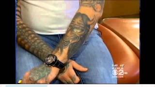 Solution or PicoSure Laser Tattoo Removal  Pittsburgh Pa [upl. by Kovacs80]