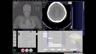 Introduction to CT Head Approach and Principles [upl. by Aicilla]